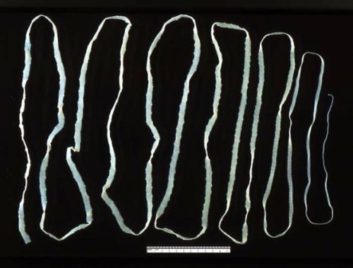 ký sinh trùng trên cơ thể người, Ấu trùng trên cơ thể người, Giun Guinea, Sán dây