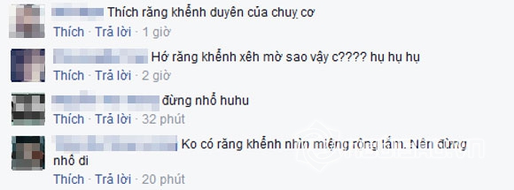 Á hậu Huyền My,Huyền My bỏ răng khểnh,răng khểnh của Huyền My,Huyền My bị chê mất duyên