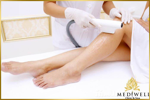 mediwell-spa-75-1-ngoisao 0 Triệt lông 6G, Triệt lông vĩnh viễn, Triệt lông, Mediwell spa