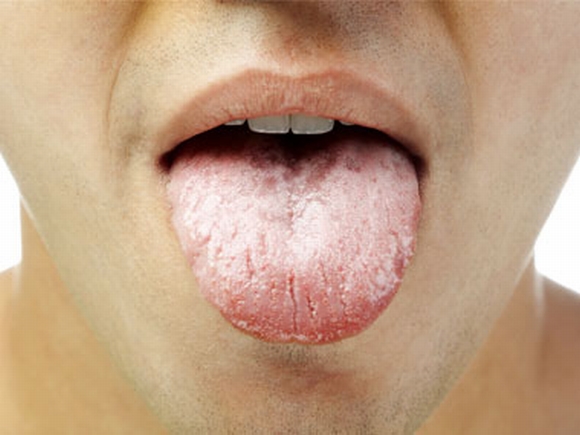 bí mật của lưỡi, tình trạng của lưỡi, bí mật của lưỡi tiết lộ tình trạng sức khỏe, màu sắc lưỡi, sức khỏe, tin, bao
