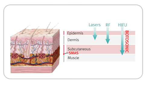 Trẻ hóa da, Trẻ hóa 1 lần duy nhất, Trẻ hóa da không phẫu thuật, Mediwell spa