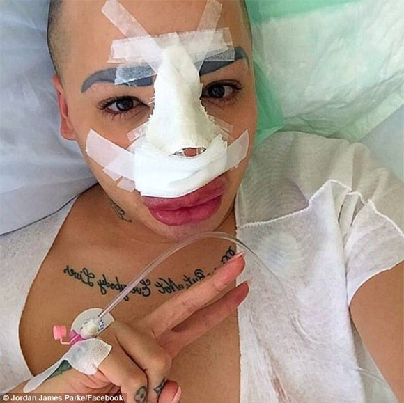 Kim Kardashian,fan cuồng của Kim Kardashian,fan cuồng phẫu thuật mũi giống Kim Kardashian