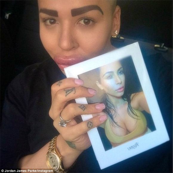Kim Kardashian,fan cuồng của Kim Kardashian,fan cuồng phẫu thuật mũi giống Kim Kardashian
