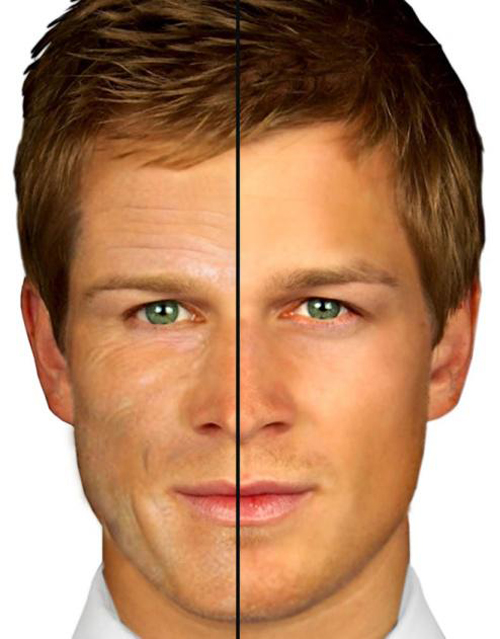 Trẻ hóa da, Chăm sóc da, Dưỡng da, BB Thanh Mai