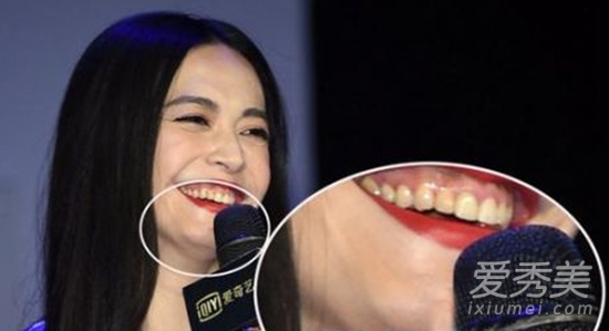 hàm răng kinh dị của sao Hoa ngữ, hàm răng sao Hoa ngữ, sao Hoa ngữ cười xấu