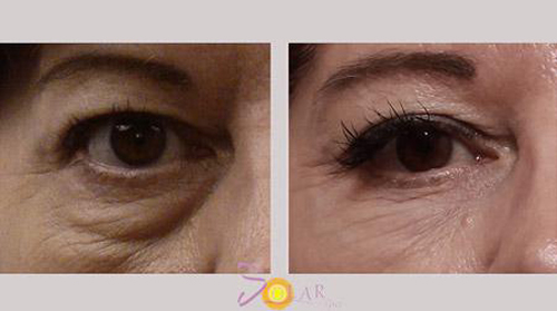 solar-spa-26-4-ngoisao 1 Trẻ hóa da, Da mặt trắng hồng, Chăm sóc da, Solar spa