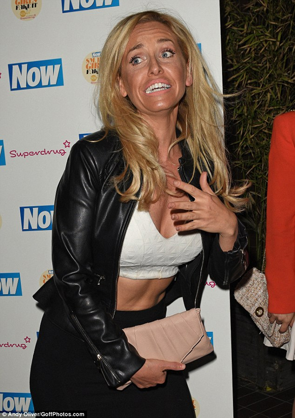 sao truyền hình Anh,Josie Gibson,Josie Gibson da đen nhẻm,Josie Gibson mặt xấu xí