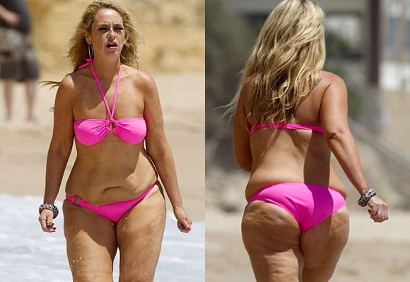 sao truyền hình Anh,Josie Gibson,Josie Gibson da đen nhẻm,Josie Gibson mặt xấu xí