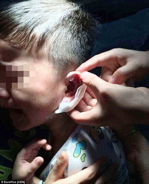  bấm ghim vào tai, bảo mẫu, giáo viên mần non bấm ghim vào tai, tin ngôi sao