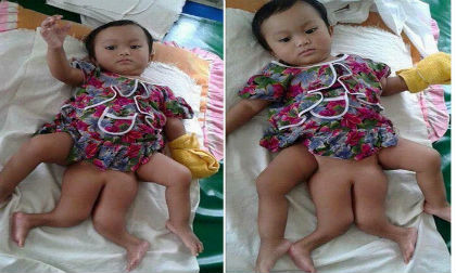 em bé giống Maruko,em bé Thái Lan,em bé có mái đầu nấm,em bé đeo kính gọng tròn