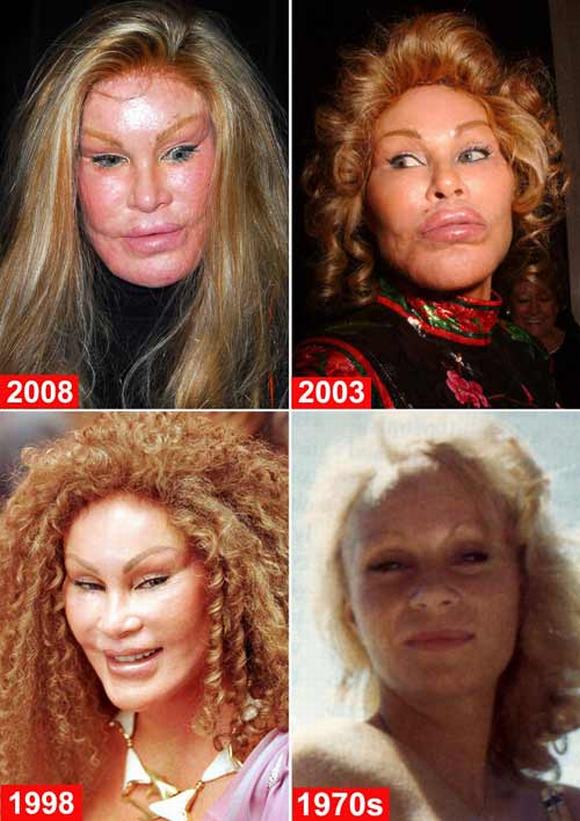 thảm họa thẩm mỹ, thảm họa dao kéo, thảm họa thẩm mỹ Jocelyn Wildenstein, Jocelyn Wildenstein, tin ngoi sao