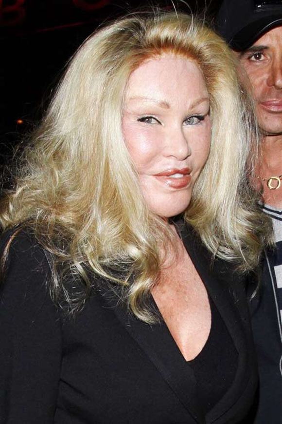 thảm họa thẩm mỹ, thảm họa dao kéo, thảm họa thẩm mỹ Jocelyn Wildenstein, Jocelyn Wildenstein, tin ngoi sao