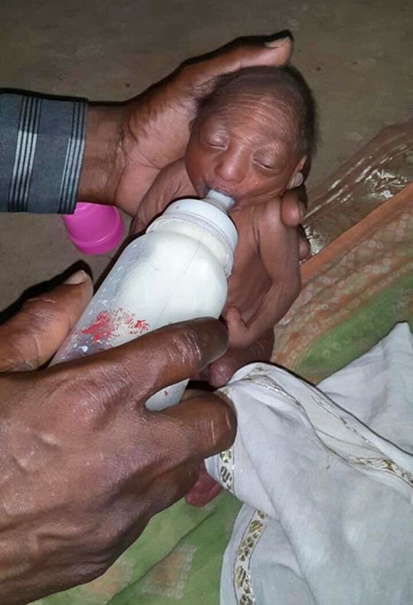 2-week-old baby abandoned by parents, abandoned, abandoned baby, baby with wrinkled skin, strange, believe the star