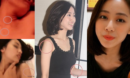 cựu Hoa hậu Hồng Kông,Dương Tư Kỳ,cựu Hoa hậu Hồng Kông hỏng mắt,cựu Hoa hậu Hồng Kông lạm dụng kính áp tròng