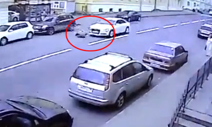 người đàn ông mọc thêm miệng và não,người đàn ông kỳ dị,Chang Tzu Ping,Chang Tzu Ping bị rối loạn phát triển cơ thể