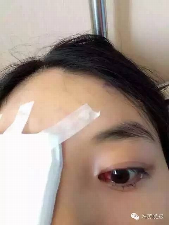 Bé 4 tuổi và mẹ bị bệnh phụ khoa vì tắm ở bể bơi, bị bệnh phụ khoa vì tắm ở bể bơi, chú ý khi bơi, tin ngôi sao