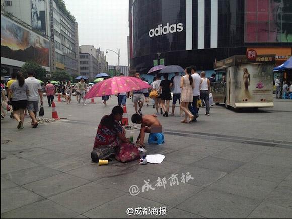 an xin de chua benh, nguoi day seo vi bong, cau be tran truong, cau be tran truong di an xin, tran truong di an xin, an xin, tran truong an xin de co tien chua benh, tin, bao