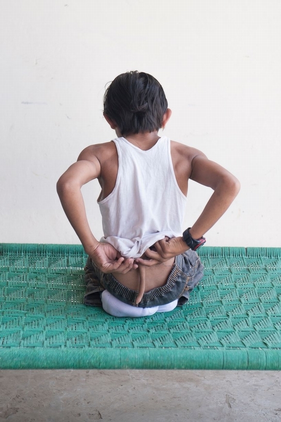  dị tật, dị tật được tôn thờ như thần thánh, kỳ dj, mặt người có vòi, người có 8 chi, kỳ lạ, tin ngôi sao