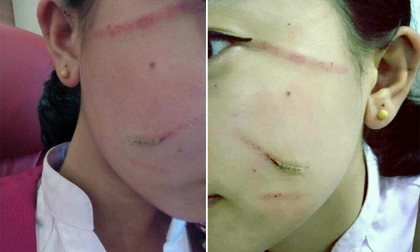 Thiếu nữ 18 tuổi bị rạch mặt, rạch mặt thiếu nữ ở Bắc Ninh, Tin pháp luật