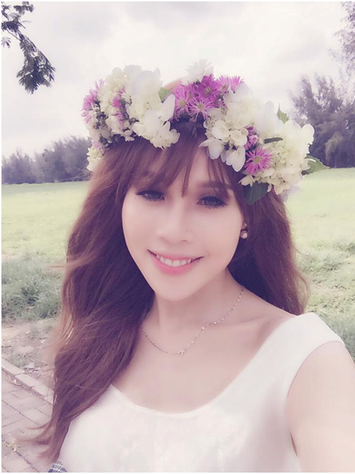 Nguyễn Thị Lan, Diễn viên múa phẫu thuật hóa thiên nga, Thẩm mỹ viện Hàn Quốc JW