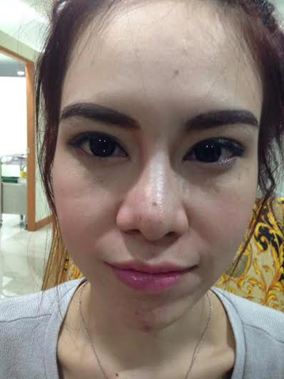 cô gái trẻ Thái Lan,chỉnh sửa mũi đau đớn,cô gái trẻ Thái Lan chỉnh sửa mũi,chỉnh sửa mũi cho thon gọn,chỉnh sửa mũi cho thanh thoát,cô gái trẻ Thái Lan phẫu thuật chỉnh sửa mũi