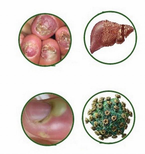 móng tay, chăm sóc móng tay, hiểm họa từ việc chăm sóc móng tay không đúng cách, chăm sóc móng tay không đúng cách, tin ngoi sao