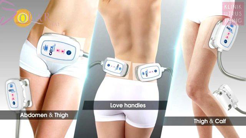 giam-beo-mot-lan-duy-nhat-219-3-ngoisao 0 Giảm béo một lần duy nhất, Công nghệ giảm béo, Solar spa