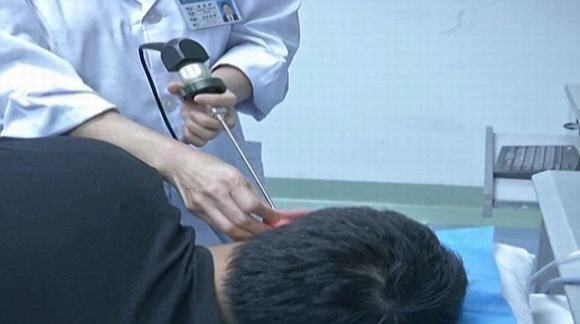 con giòi, con giòi trong tai, nhiễm ký sinh trùng, lấy giòi trong tai