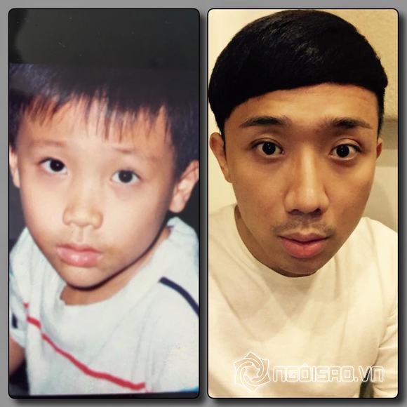 tran thanh, mc tran thanh, tran thanh luc nho, anh qua khu cua tran thanh, 