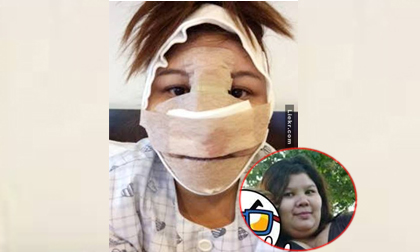cô gái Thái Lan,cô gái Thái Lan vịt hóa thiên nga,cô gái Thái Lan lột xác nhờ dao kéo, phẫu thuật thẩm mỹ