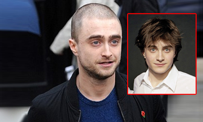 Daniel Radcliffe,Daniel Radcliffe bị nghi dính nCoV,Harry Potter