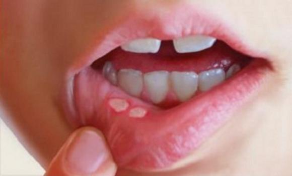 biểu hiện của răng miệng, sức khỏe qua răng miệng, bệnh răng miệng, đoán bệnh răng miệng, biểu hiện của răng miệng