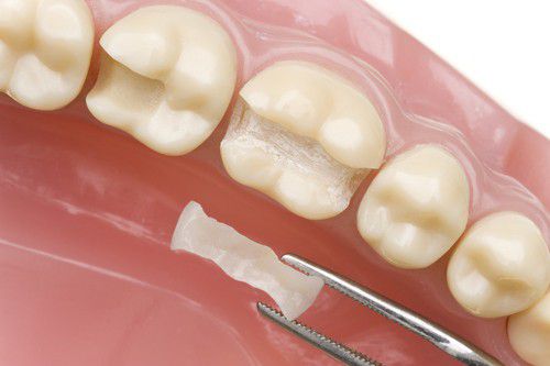 biểu hiện của răng miệng, sức khỏe qua răng miệng, bệnh răng miệng, đoán bệnh răng miệng, biểu hiện của răng miệng