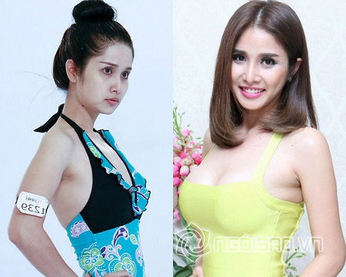sao Việt,sao Việt cởi mờ thừa nhận dao kéo,sao Việt nâng cấp vòng một,sao Việt chỉnh sửa cơ thể,sao Việt được khán giả chú ý
