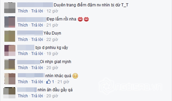 Kỳ Duyên tiếp tục bị nghi phẫu thuật thẩm mỹ vì cằm nhọn bất thường 8