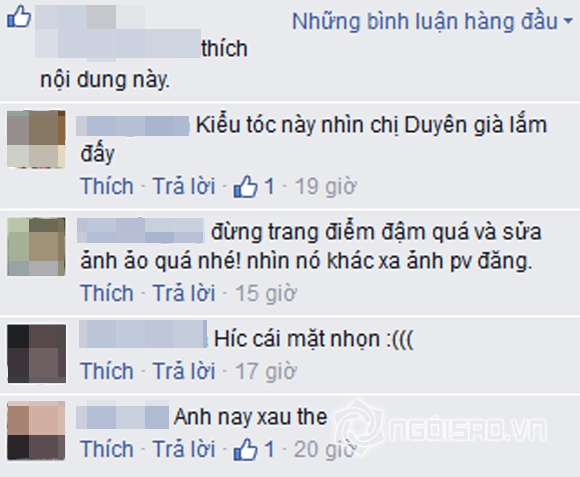Kỳ Duyên tiếp tục bị nghi phẫu thuật thẩm mỹ vì cằm nhọn bất thường 3