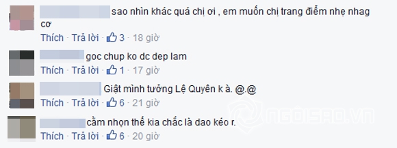 Kỳ Duyên tiếp tục bị nghi phẫu thuật thẩm mỹ vì cằm nhọn bất thường 5