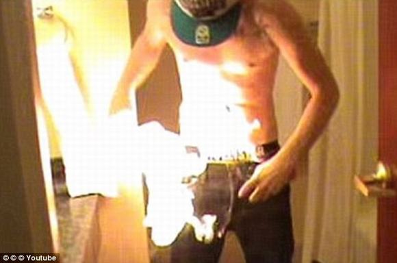 đốt lửa trên người, bỏng vì đốt lửa trên người, fire challenge