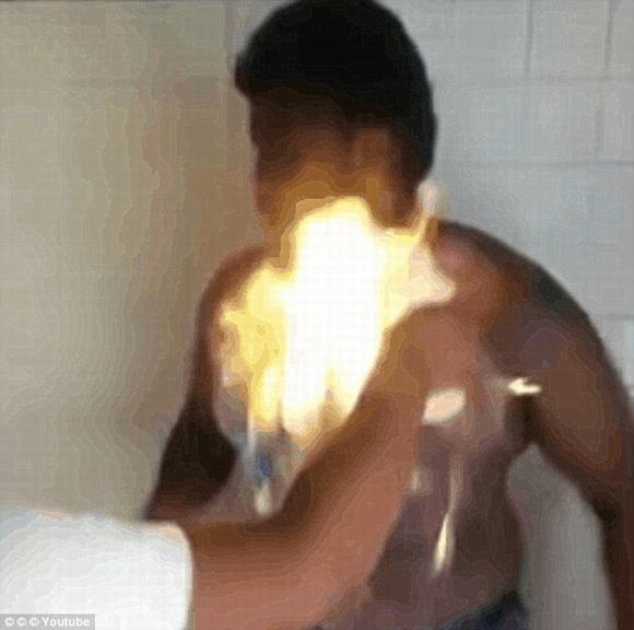 đốt lửa trên người, bỏng vì đốt lửa trên người, fire challenge