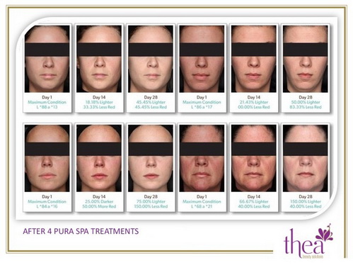 thea-beauty-1712-8-ngoisao 0 Thea Beauty Solutions, Thẩm mỹ viện Thea, Làm trắng da