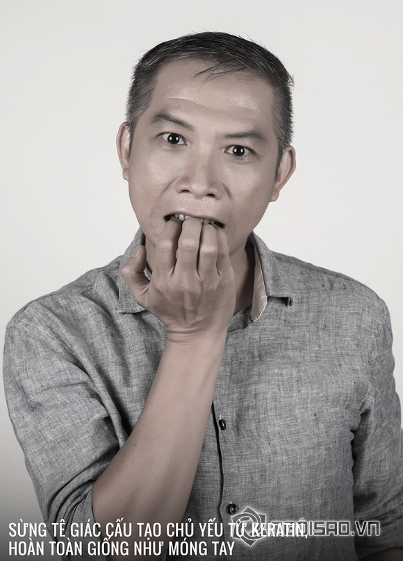 “Những kẻ cắn móng tay”, Nail Biters, sao Việt ung hộ chiến dịch bảo vệ tê giác, nghệ sĩ việt với chiến dịch cắn móng tay