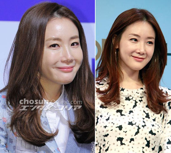 Choi Ji Woo,Choi Ji Woo mặt sưng phồng,sao hàn