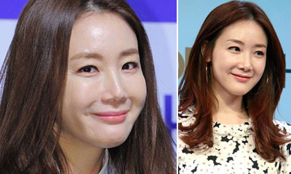 sao Hàn,mỹ nhân Bản tình ca mùa đông,làn da đẹp của sao Hàn,Choi Ji Woo