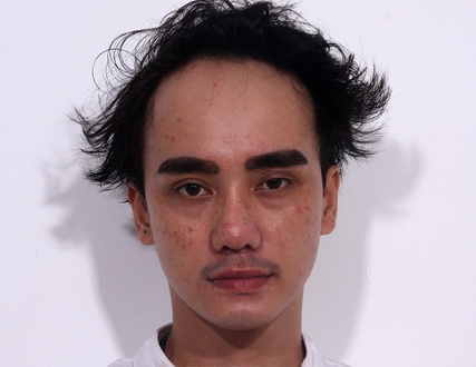 ha-nhuan-nam-121-1-ngoisao 14 Bệnh viện Thẩm mỹ Hiệp Lợi, Hà Nhuận Nam, Hot boy dao kéo