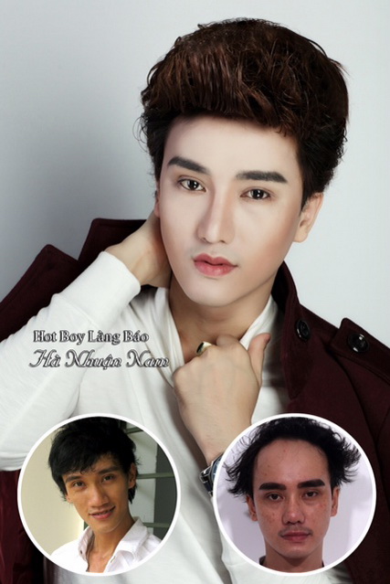 ha-nhuan-nam-121-14-ngoisao 1 Bệnh viện Thẩm mỹ Hiệp Lợi, Hà Nhuận Nam, Hot boy dao kéo