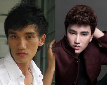 ha-nhuan-nam-121-3-ngoisao 12 Bệnh viện Thẩm mỹ Hiệp Lợi, Hà Nhuận Nam, Hot boy dao kéo