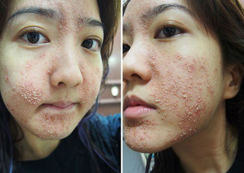 trang-da-181-2-ngoisao 0 Mỹ phẩm Ngọc Ân, Làm trắng da, Làm trắng da an toàn