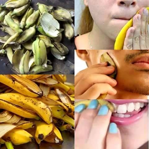 vỏ chuối, lợi ích của vỏ chuối, tác dụng vỏ chuối