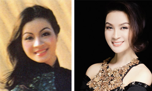 Trẻ hóa da, Lão hóa da, BB Thanh Mai