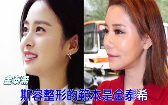 MC Đài Loan,MC Đài Loan Tư Dung,MC Đài Loan dao kéo giống Kim Tae Hee